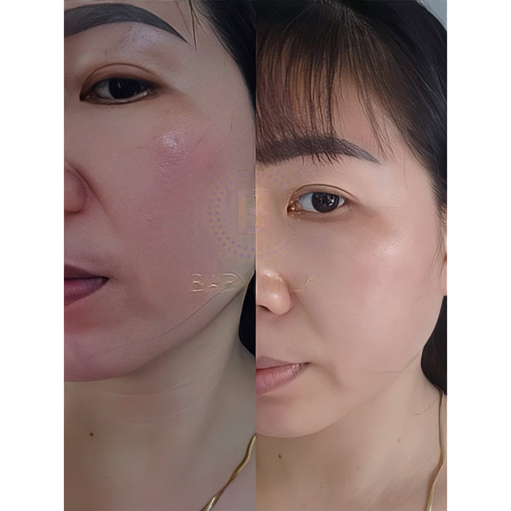 [Hot] Kem Mao Mạch Baby Milk Phục Hồi Da Mỏng Đỏ Nhiễm Corticoid 20g - Hàng Hiệu Cao Thiên Nhi