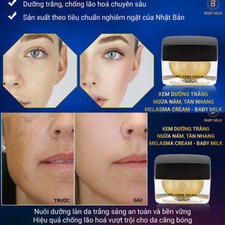 [Hot] Kem Dưỡng Trắng Ngừa Nám Melasma Cream Baby Milk 30g - Hàng Hiệu Cao Thiên Nhi