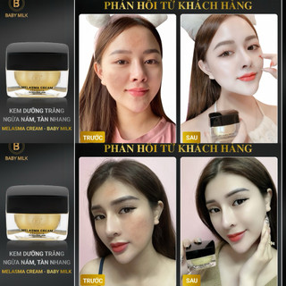 [Hot] Kem Dưỡng Trắng Ngừa Nám Melasma Cream Baby Milk 30g - Hàng Hiệu Cao Thiên Nhi
