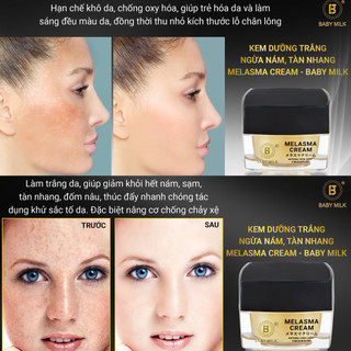 [Hot] Kem Dưỡng Trắng Ngừa Nám Melasma Cream Baby Milk 4.5g - Hàng Hiệu Cao Thiên Nhi
