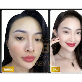 [Hot] Kem Dưỡng Trắng Ngừa Nám Melasma Cream Baby Milk 4.5g - Hàng Hiệu Cao Thiên Nhi