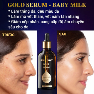 Serum Dưỡng Trắng Ngăn Ngừa Nám Mụn Gold Serum - Baby Milk 100ml - Hàng Hiệu Cao Thiên Nhi