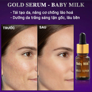 [Mới] Serum Dưỡng Trắng Ngăn Ngừa Nám Mụn Gold Serum - Baby Milk 10ml - Hàng Hiệu Cao Thiên Nhi