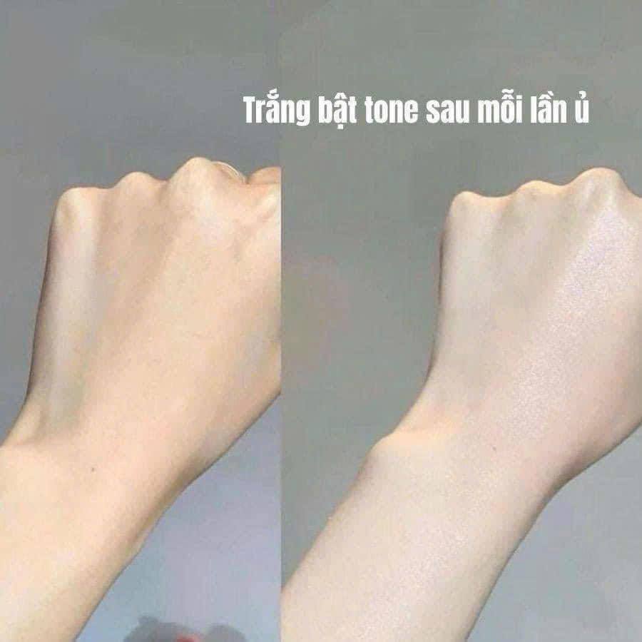 Kem ủ trắng body Revita White Ex Pack