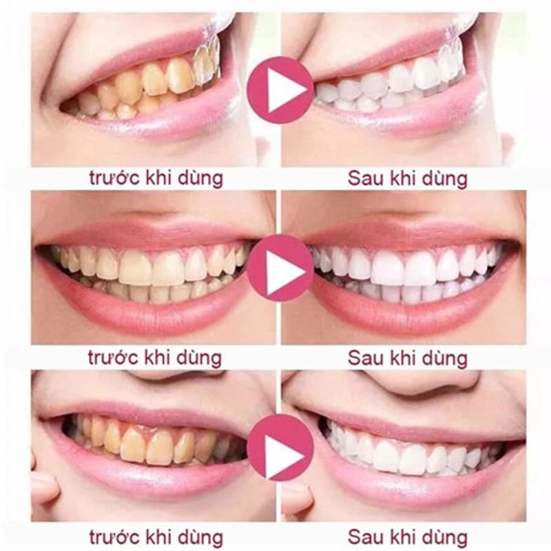 Viên kem đánh răng dạng rắn, Kem đánh răng nhai cầm tay, Chăm sóc răng miệng, Kem đánh răng nhaiHơi thở thơm mát
