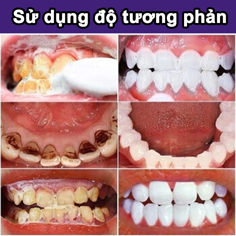 Viên kem đánh răng dạng rắn, Kem đánh răng nhai cầm tay, Chăm sóc răng miệng, Kem đánh răng nhaiHơi thở thơm mát