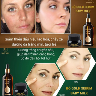 [Hot] Bộ Kem Dưỡng Trắng Ngăn Ngừa Nám Mụn Gold Serum Baby Milk - Hàng Hiệu Cao Thiên Nhi