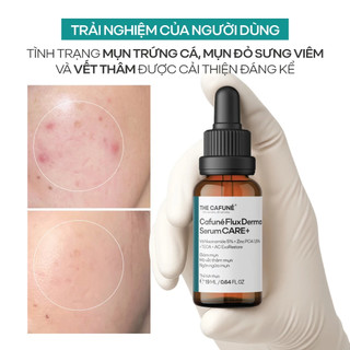 Tinh Chất Đánh Bật Mụn Và Cân Bằng Dầu Nhờn Cafuné Flux Derma 19ml Dành Cho Da Dầu Mụn