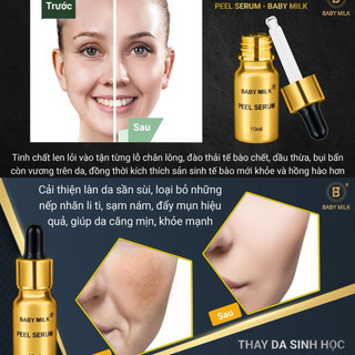 [Hot] Thay Da Sinh Học Peel Serum Baby Milk 10ml - Hàng Hiệu Cao Thiên Nhi