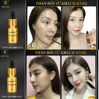 [Hot] Thay Da Sinh Học Peel Serum Baby Milk 10ml - Hàng Hiệu Cao Thiên Nhi