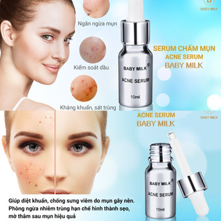 [Hot] Serum Acne Chấm Mụn Baby Milk 10ml - Hàng Hiệu Cao Thiên Nhi