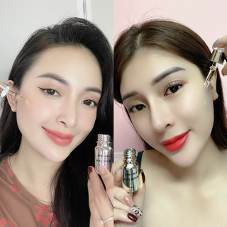 [Hot] Serum Acne Chấm Mụn Baby Milk 10ml - Hàng Hiệu Cao Thiên Nhi