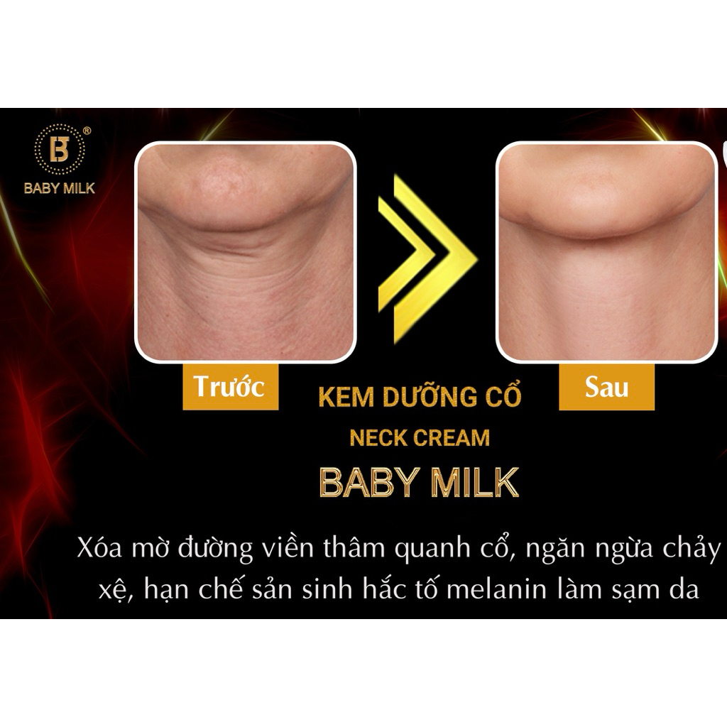 [Hot] Kem Dưỡng Cổ Neck Cream Baby Milk 7g - Hàng Hiệu Cao Thiên Nhi