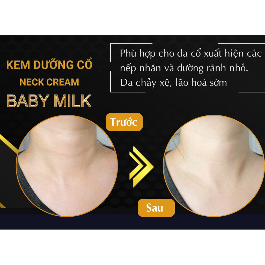 [Hot] Kem Dưỡng Cổ Neck Cream Baby Milk 7g - Hàng Hiệu Cao Thiên Nhi