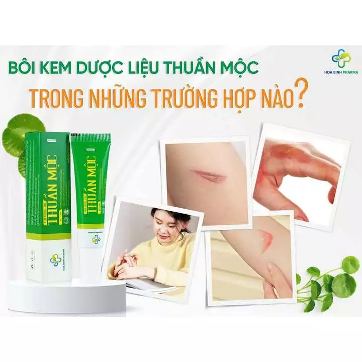Kem mờ sẹo dược liệu Thuần Mộc, giúp dưỡng ẩm, làm mờ các vết thâm, sẹo trên da, phục hồi tổn thương