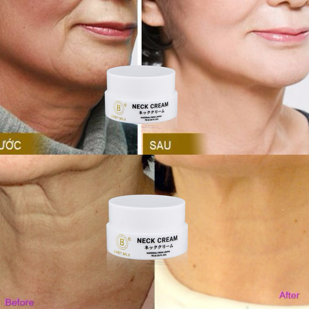 [Hot] Kem Dưỡng Cổ Neck Cream Baby Milk 7g - Hàng Hiệu Cao Thiên Nhi