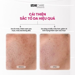 Serum Sáng Da Đa Tầng Và Toàn Diện Thế Hệ Mới MD CARE Brightenyl Serum 30ml