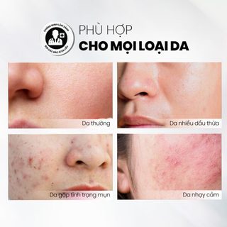 Sữa Rửa Mặt Dịu Nhẹ Và Cấp Ẩm Cho Da Nhạy Cảm MD CARE Hydrating Milk Cleanser 200ml