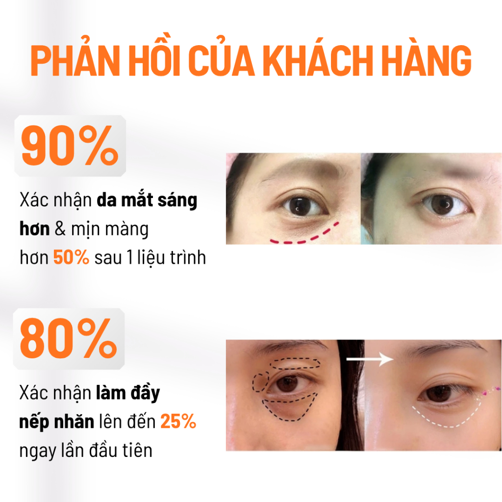 Sử dụng Kem Bôi trong đời sống