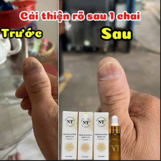 Combo dưỡng móng NT (chính hãng)