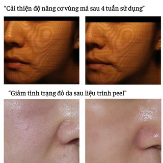 [QUÀ TẶNG] Mặt Nạ Phục Hồi Da The ILLON Post Protective Soothing Mask 37g | Cấp Ẩm Sâu, Giảm Kích Ứng, Da Khỏe Mịn