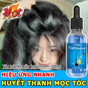 Serum mọc tóc Tinh chất dưỡng tóc Tinh Chất Chống Rụng Tóc kích thích mọc tóc nhanh làm dày giúp giảm rụng tóc giải