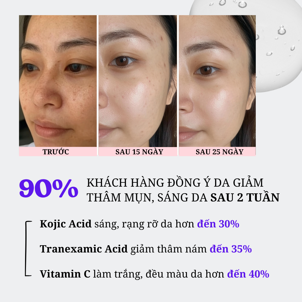 Serum Căng Bóng Da, Loại Bỏ Thâm Mụn, Nám Lâu Năm, Đều Màu Da Trong 15 Ngày