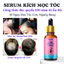 SERUM KÍCH MỌC TÓC NHANH DÀI, Ngăn Rụng Tóc, Hói Đầu, Dưỡng Tóc Dày, Dài, Khoẻ ZZ3