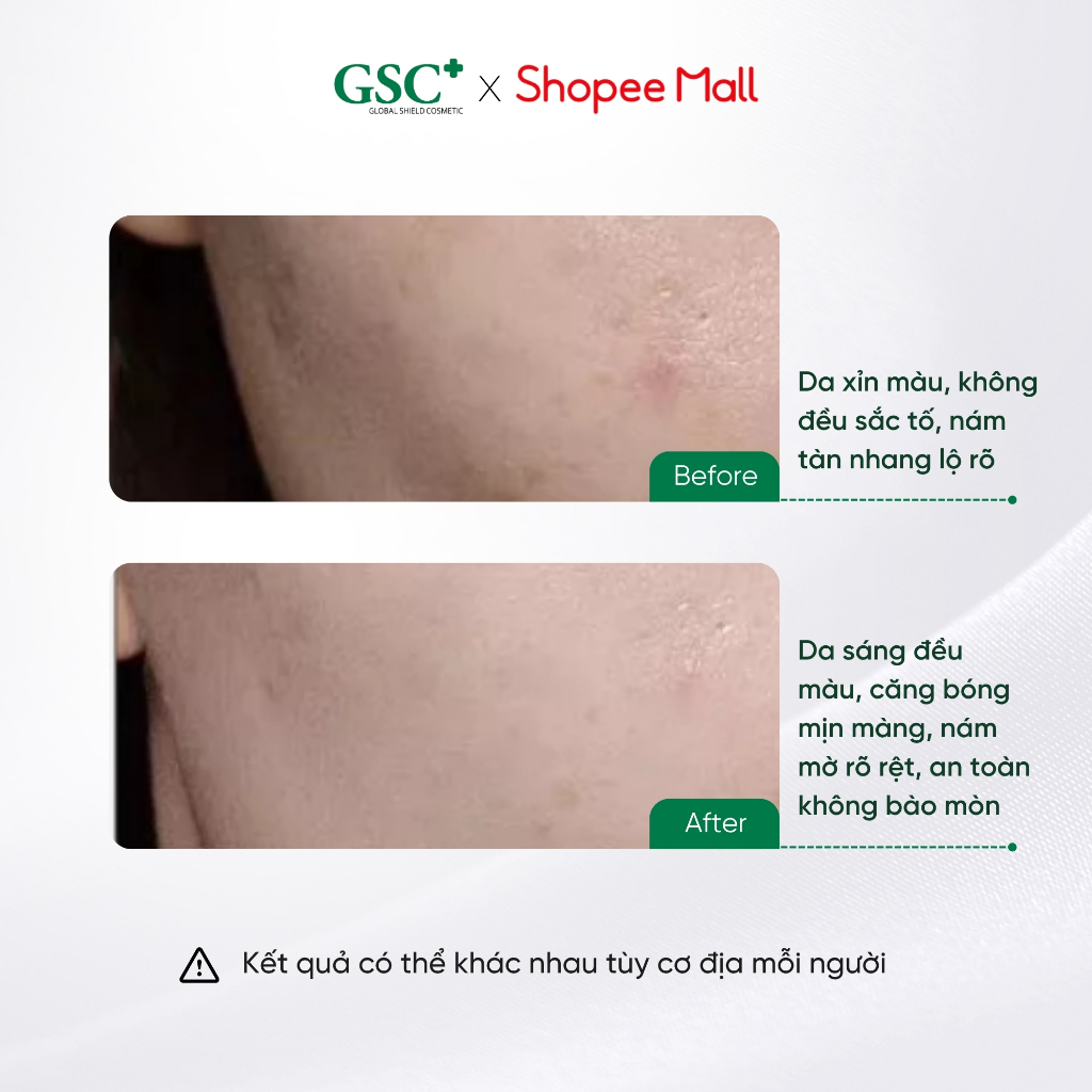 Serum Trắng Da, Mờ Nám, Thâm Mụn Hàn Quốc GSC Giga White 15ml - Serum Làm Trắng Da, Mờ Thâm Mụn, Giảm Nám - GC083A