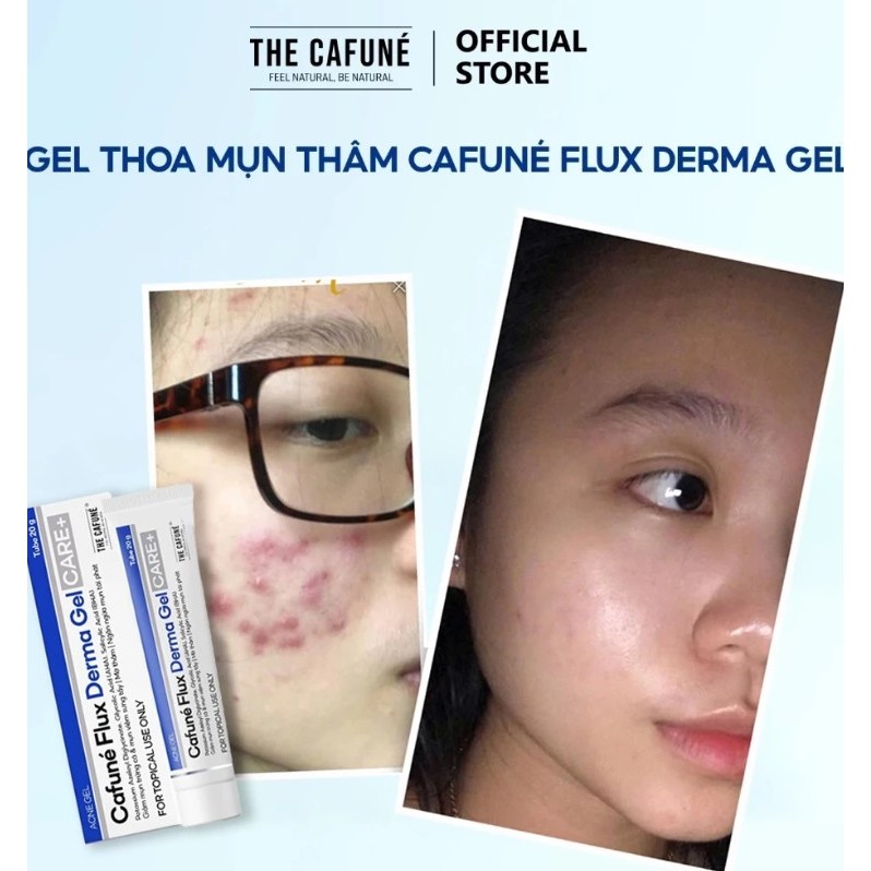Gel Giảm Mụn Và Thâm Cafuné Essence 15gram mẫu mới!!!
