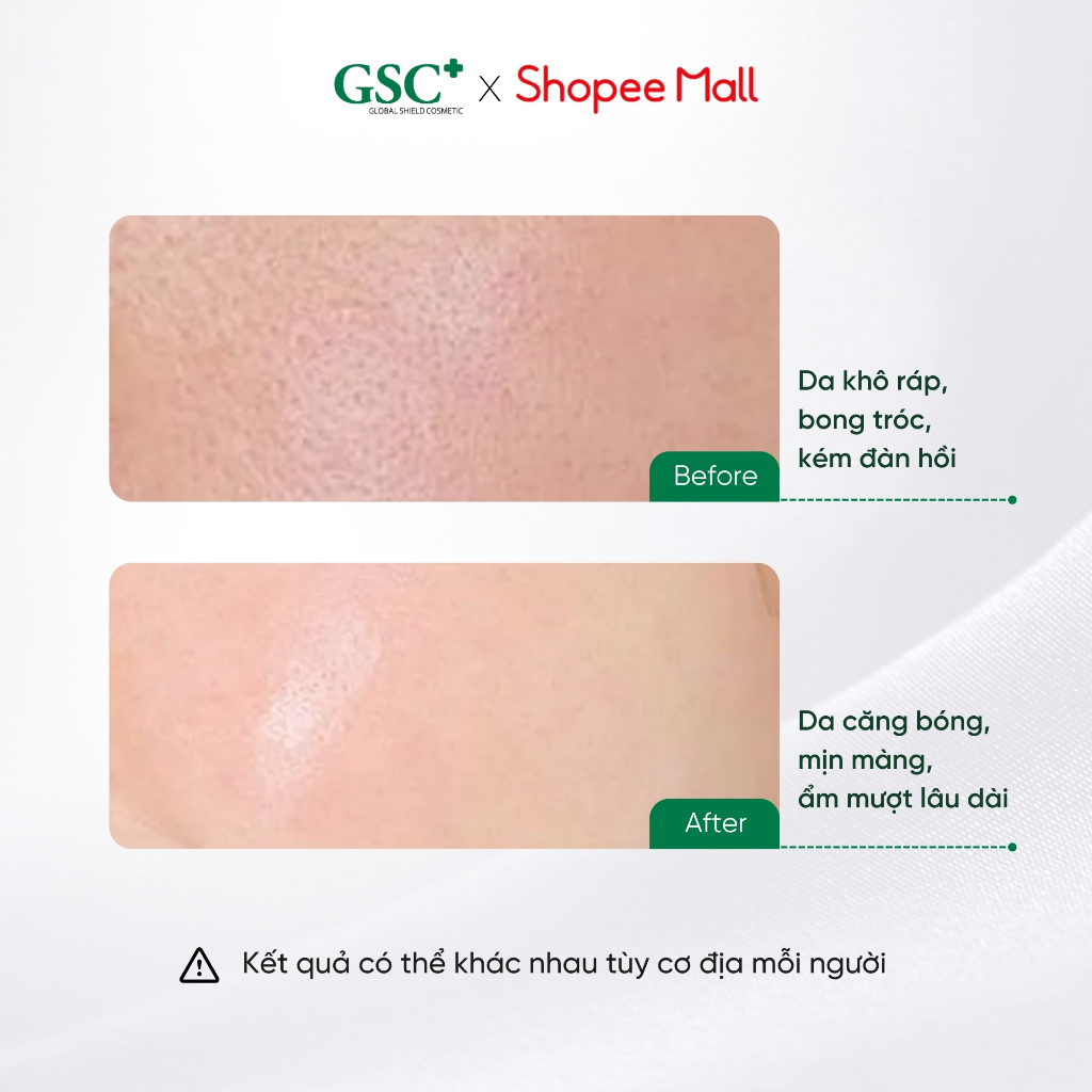 Serum Dưỡng Ẩm, Căng Bóng GSC Hyaluronic Serum 50ml – Serum Căng Bóng Da, Dưỡng Ẩm Chuyên Sâu - GC023A