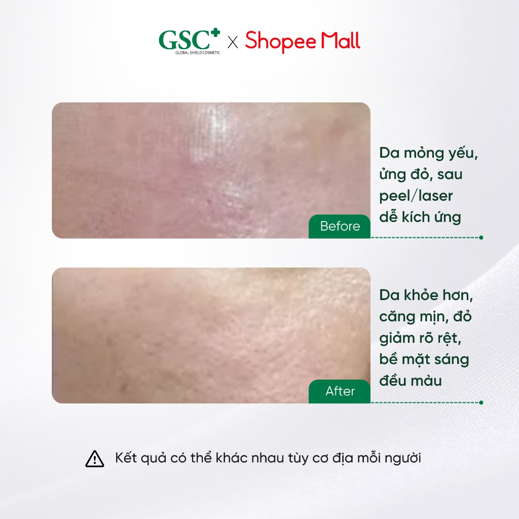 Serum Phục Hồi Da, Giảm Đỏ, Chống Lão Hóa GSC Advanced Repair Serum 15ml cho Da Peel, Da Mỏng Yếu - GC082A