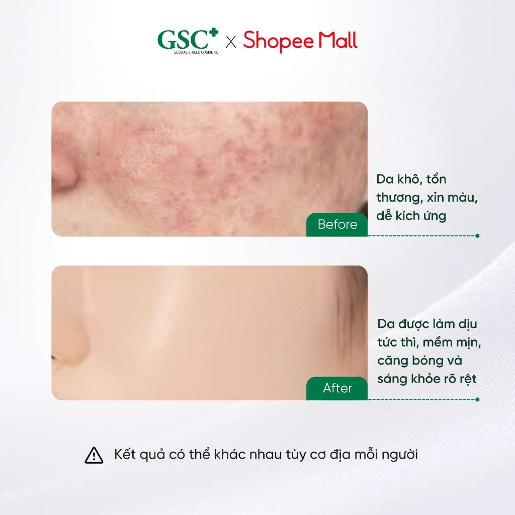 Mặt Nạ Dưỡng Ẩm Phục Hồi, Làm Dịu Da Sau 5 Phút Hàn Quốc GSC Rebirth & Recovery Mask 30ml x 10 Miếng /Hộp - GC068A