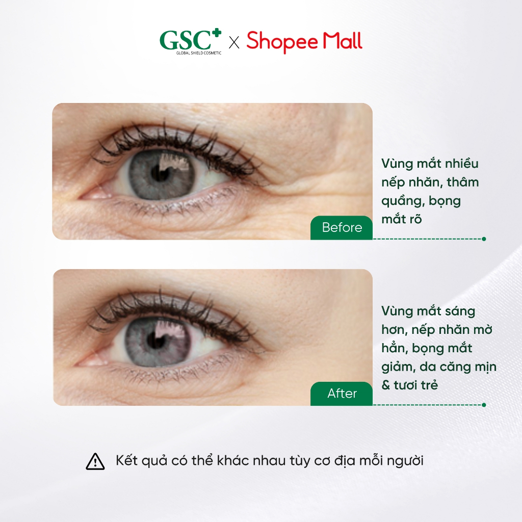 Kem Giảm Thâm Mắt GSC Anti Wrinkle Eye Cream 15ml - Kem Mắt Hỗ Trợ Giảm Bọng Mắt, Giảm Nhăn - GC043A