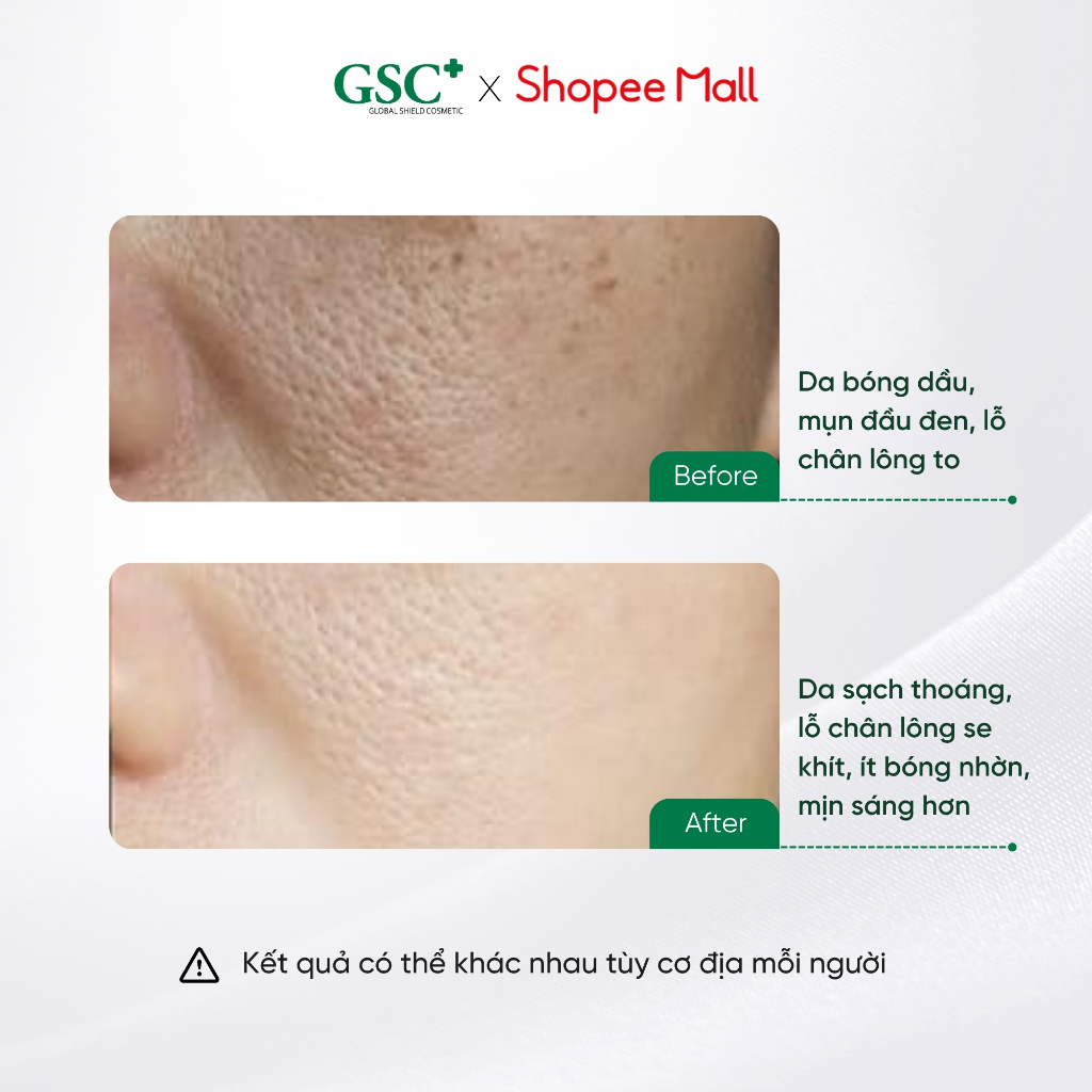 Mặt Nạ Đất Set Kiềm Dầu Giảm Mụn Đầu Đen Hàn Quốc GSC Sebum Control Modeling Mask 7ml x 10 Gói/hộp - EC089A