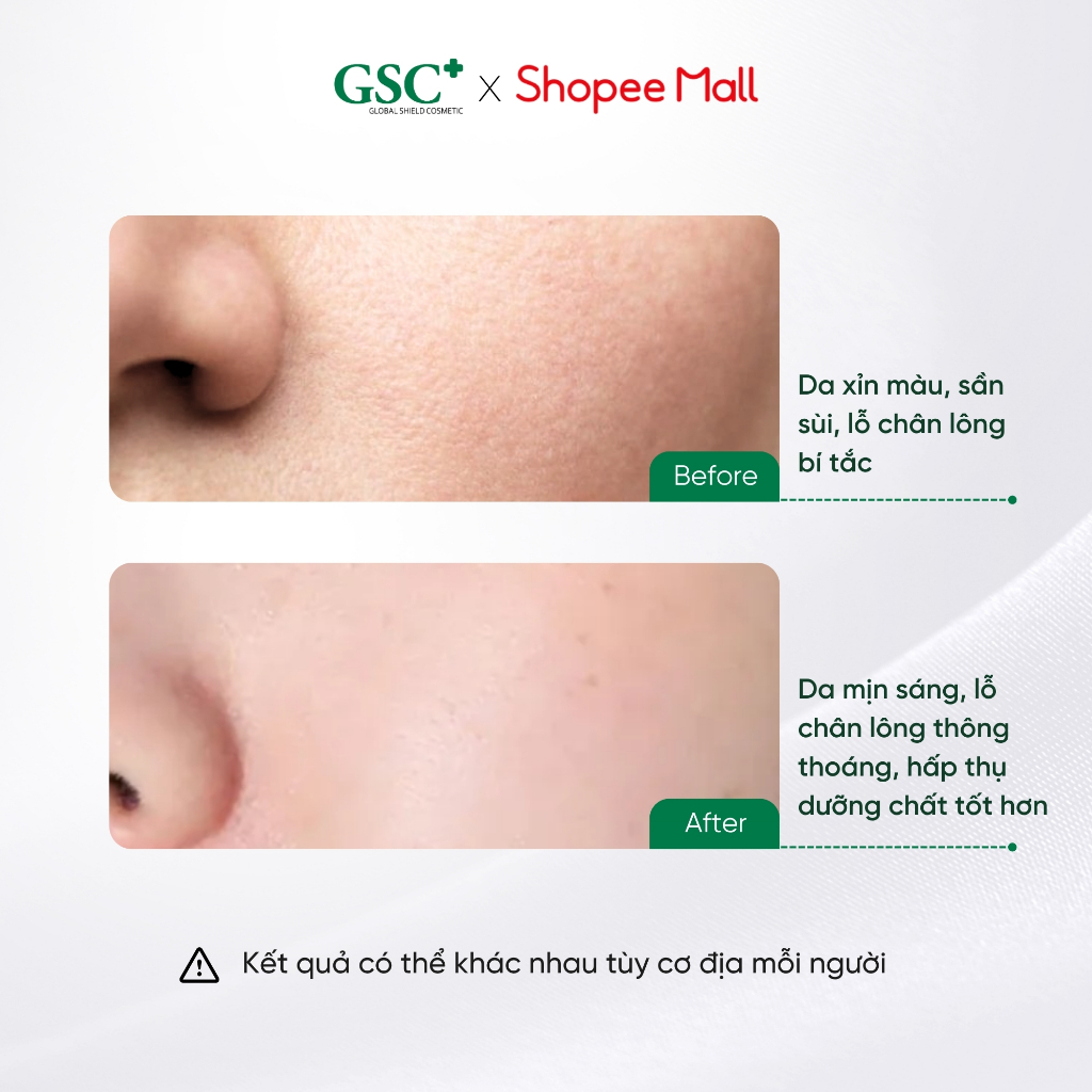 Tẩy Da Chết Sinh Học GSC Natural Peeling – Peeling Da Làm Sạch Nhẹ Nhàng, Không Bào Mòn - GC101A