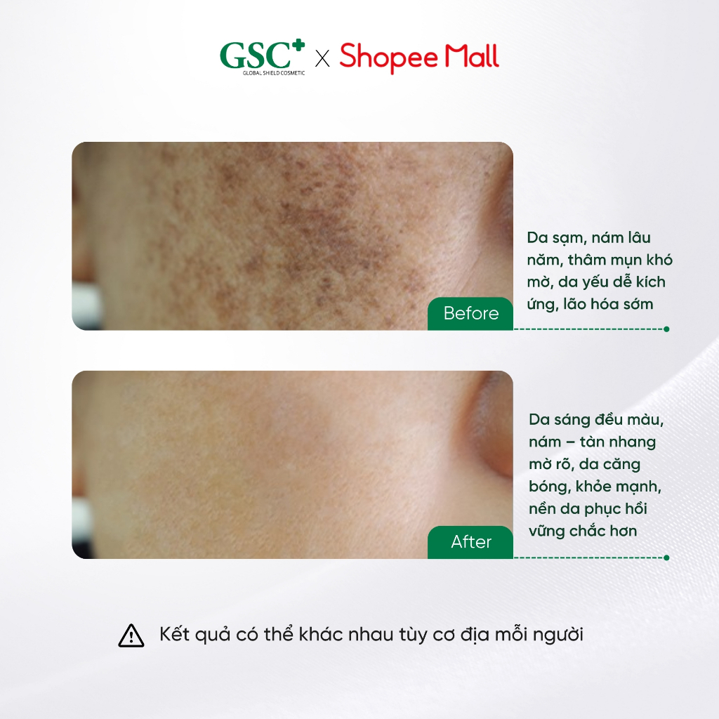Bộ Đôi Serum Dưỡng Sáng, Mờ Thâm Nám DAY & NIGHT MELA BRIGHT SERUM 30 ML Hỗ Trợ Sáng Da, Mờ Nám - S2