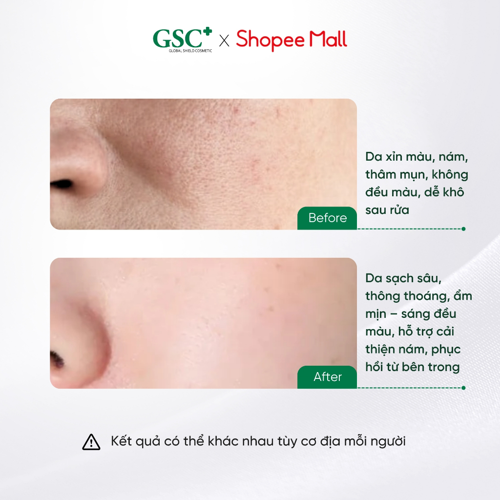 Sữa Rửa Mặt Cho Da Nám, Không Đều Màu GSC Mela Bright Cleanser 150ml - Hỗ Trợ Giảm Nám, Sáng Da - GC093A