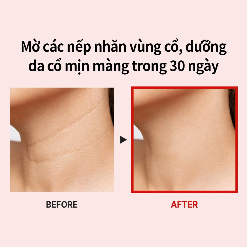 [HÀNG CHÍNH HÃNG] Kem dưỡng da vùng cổ MEDIPEEL sợi naite cao cấp chống lão hóa 100ml