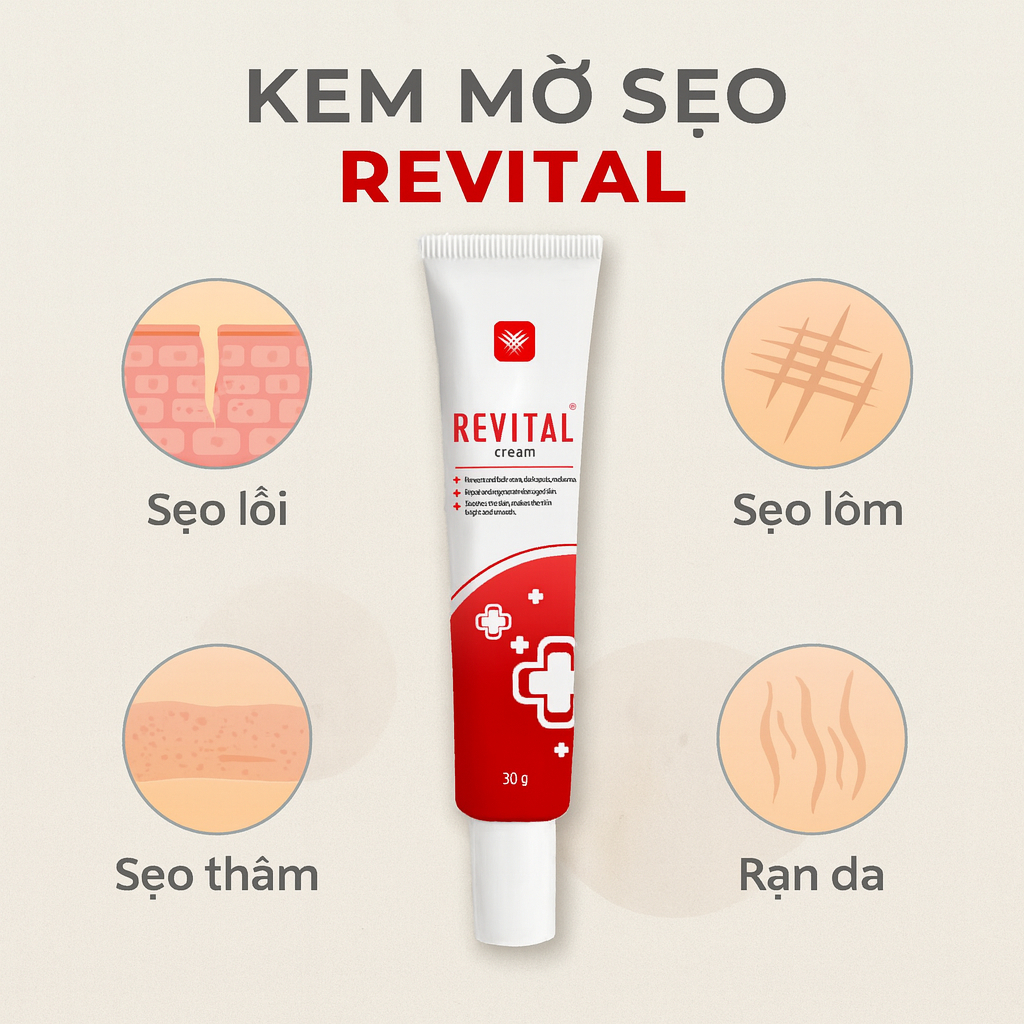 Kem Revital 30g - Hỗ Trợ Mờ Sẹo, Thâm Mụn, Rạn Da - Lành Tính Cho Da