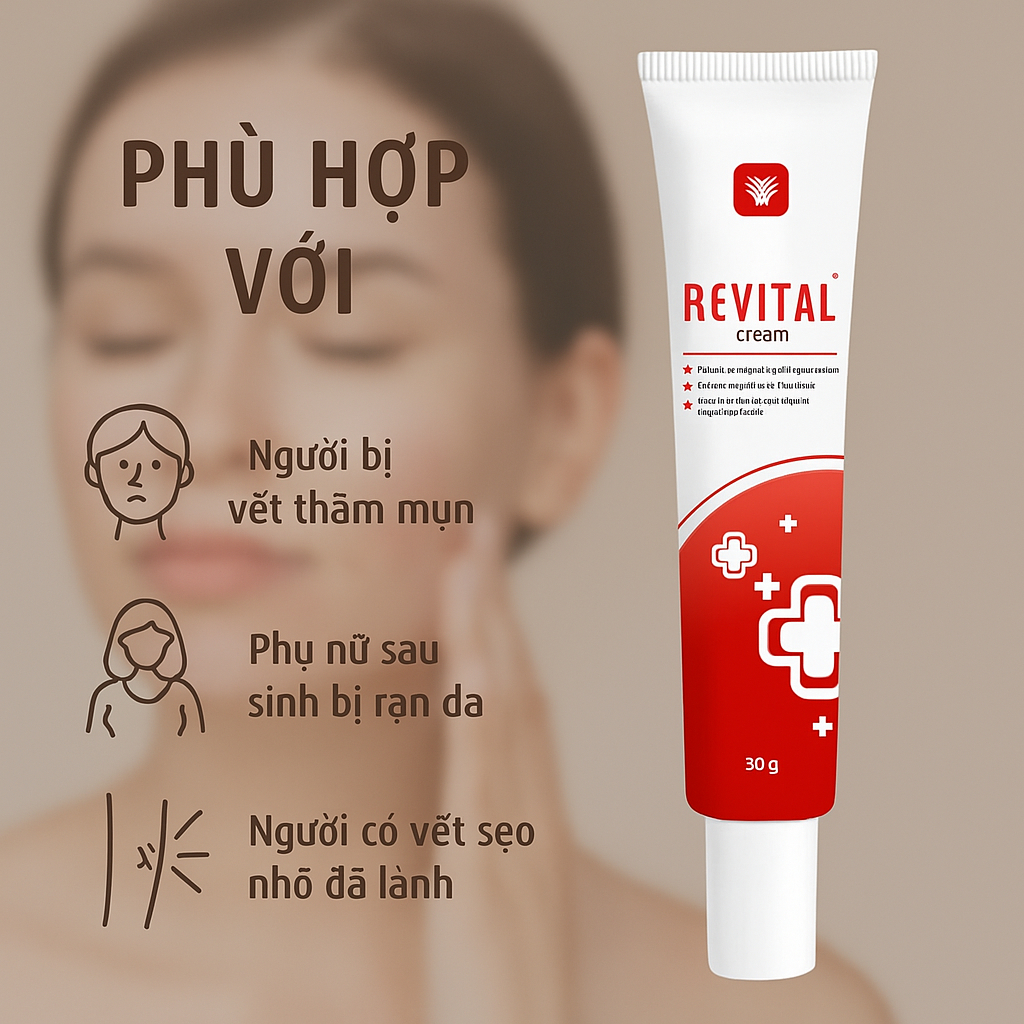 Kem Revital 30g - Chuyên biệt cho da sẹo, thâm sau mụn, rạn da - Giúp da sáng khỏe, đều màu