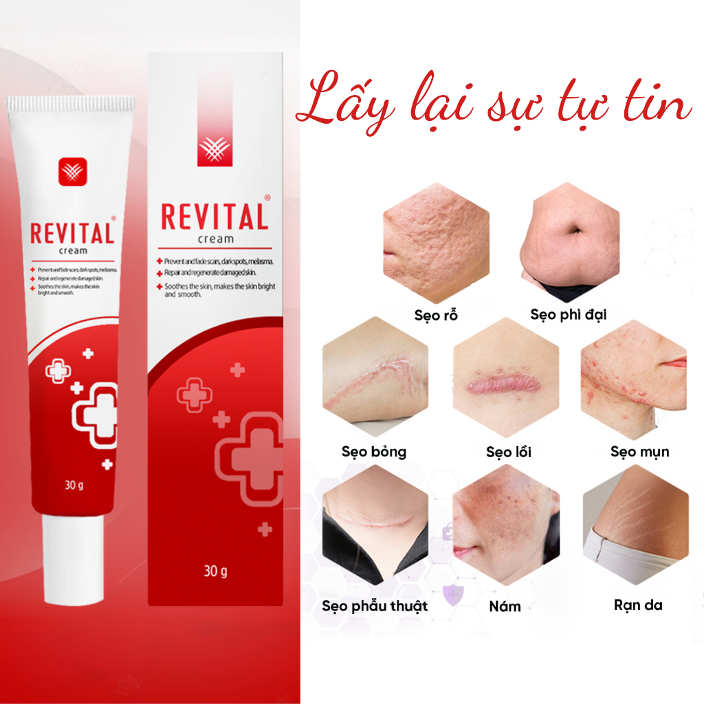 Kem Revital 30g - Hỗ Trợ Mờ Sẹo, Thâm Mụn, Rạn Da - Lành Tính Cho Da