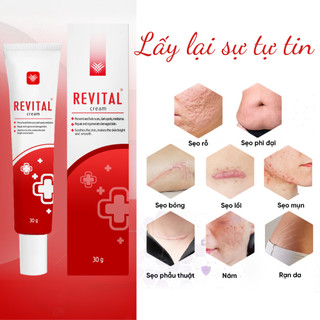 Combo 2 Tuýp Hỗ Trợ Mờ Sẹo Revital 30g - Cải Thiện Sẹo Rỗ, Sẹo Lồi, Thâm Mụn, Rạn Da