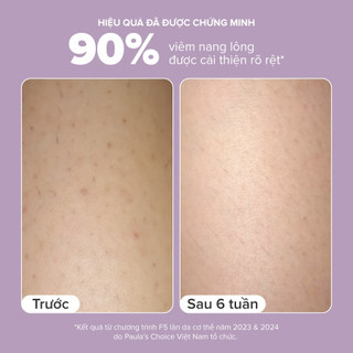 [FBS] Kem dưỡng thể hỗ trợ giảm mụn và làm mịn da Paula's Choice 2% BHA Body Smoothing Spot Exfoliant 60ml