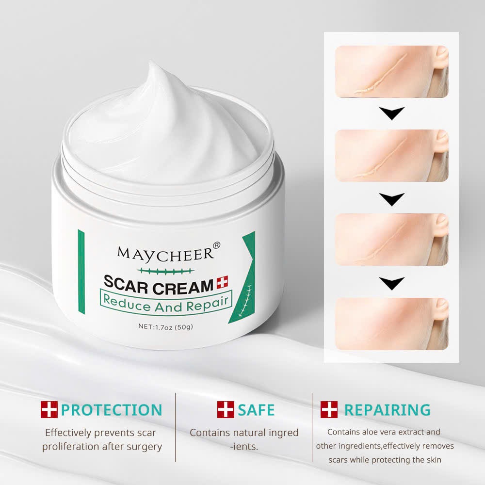 Kem Mờ Thâm Sẹo, Lồi, Lõm, Bỏng Da, rạn da MAYCHEER – MAYCHEER Giải Pháp Mịn Da, Làn Da Không Tỳ Vết