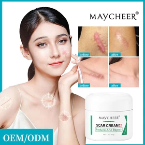 Kem Mờ Thâm Sẹo, Lồi, Lõm, Bỏng Da, rạn da MAYCHEER – MAYCHEER Giải Pháp Mịn Da, Làn Da Không Tỳ Vết