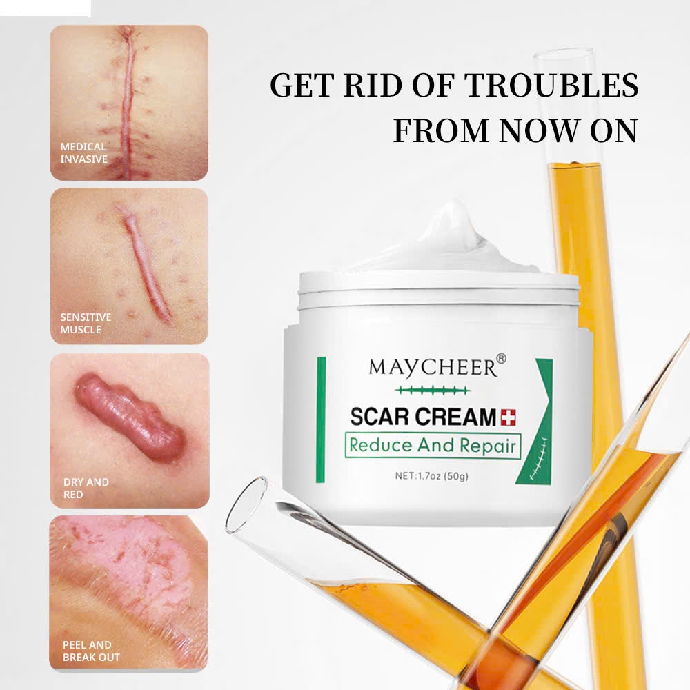 Kem Mờ Thâm Sẹo, Lồi, Lõm, Bỏng Da, rạn da MAYCHEER – MAYCHEER Giải Pháp Mịn Da, Làn Da Không Tỳ Vết