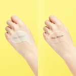 Mặt Nạ Mắt MediAnswer Vita Collagen Eye Cream Patch Cải Thiện Quầng Thâm Và Nếp Nhăn — ảnh 4