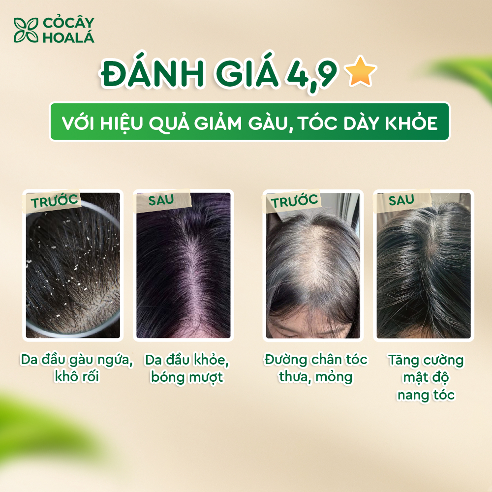 7.7 Combo Dầu Gội Xả Thảo Dược Gừng Dừa Cỏ Cây Hoa Lá - 650g/chai Tặng Kèm Túi Vải