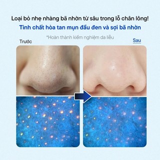 One-day's you - Serum Giảm Mụn Đầu Đen - P.Z. Ssoc Ssoc No More Blackhead 100ml | Clycos Phân Phối